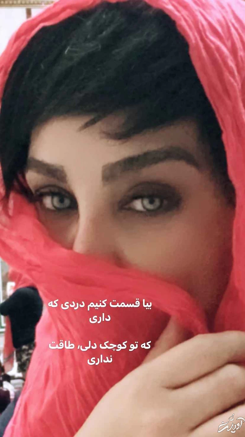 این خانم بازیگر رکورددار جراحی زیبایی ایرانی ! + تصاویری افشاگر !